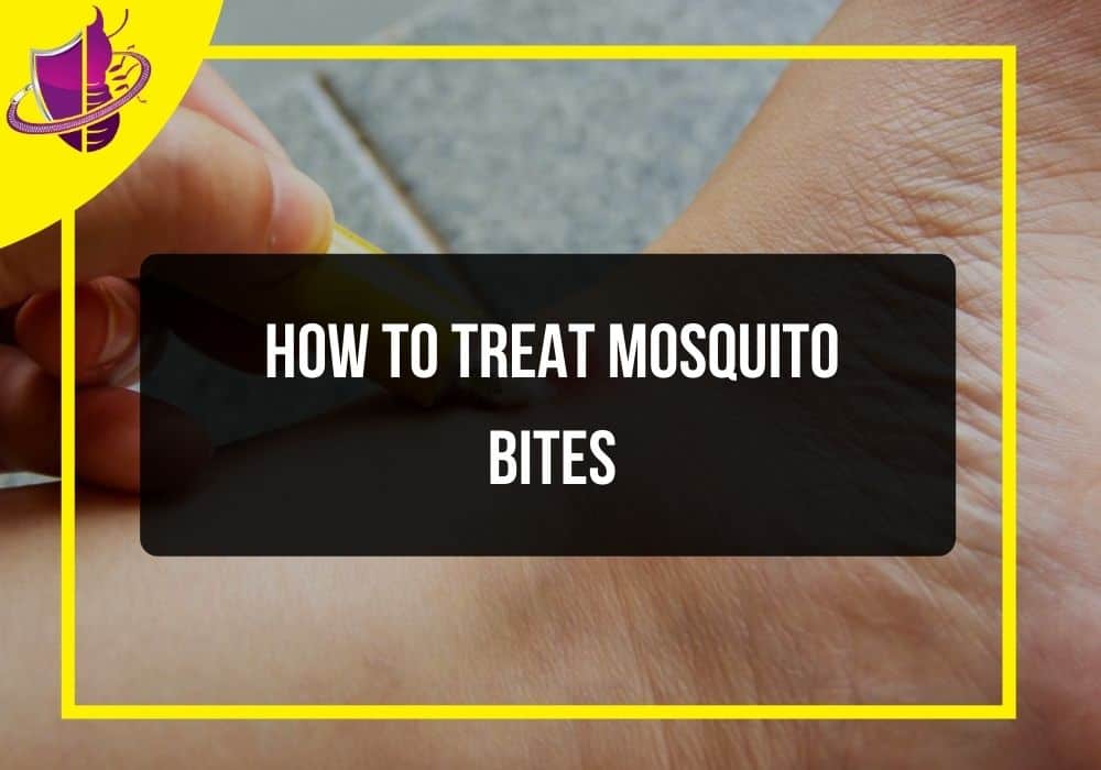You are currently viewing How To Treat Mosquito Bites
